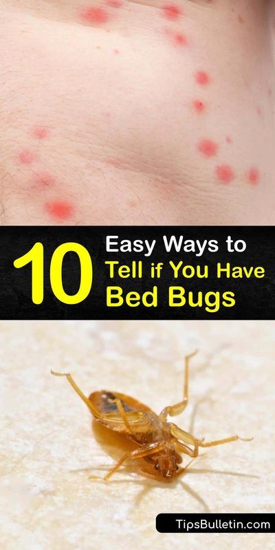 10 Easy Ways to Tell if You have Bed Bugs