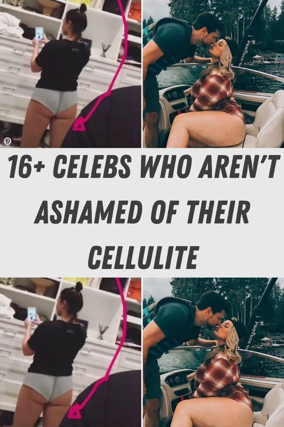 16+ Celebs Who Aren'T Ashamed Of Their Cellulite
