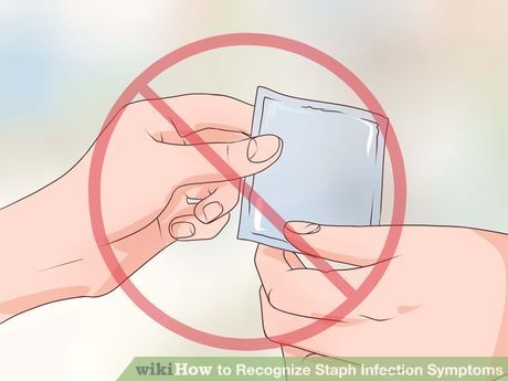 3 Ways To Recognize Staph Infection Symptoms Wikihow Images
