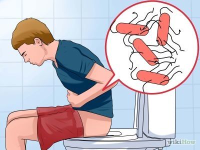 4 Ways to Stop Diarrhea Caused by IBS - wikiHow