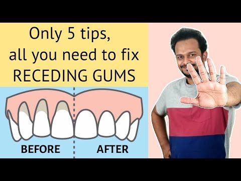 5 Habits to Naturally Heal Sensitive Teeth, Reverse Receding Gums,