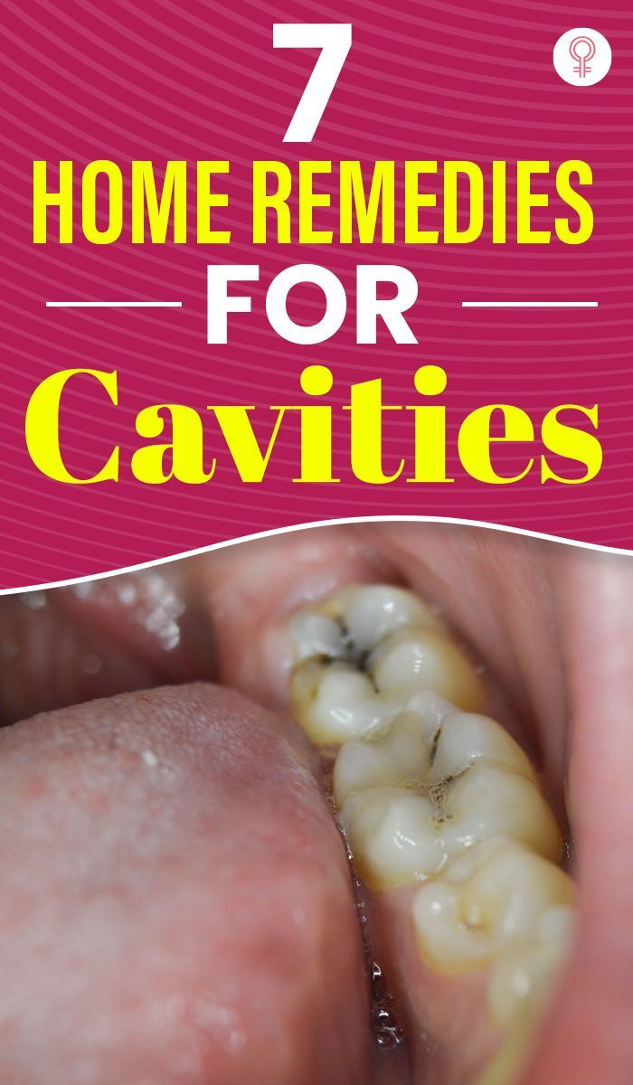7 Home Remedies For Cavities