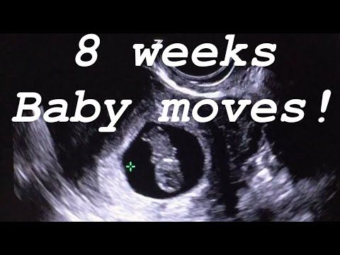 8 Weeks Ultrasound. Baby Moves.