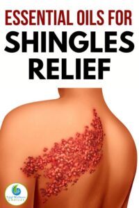 9 Best Essential Oils for Shingles Pain HD Wallpaper