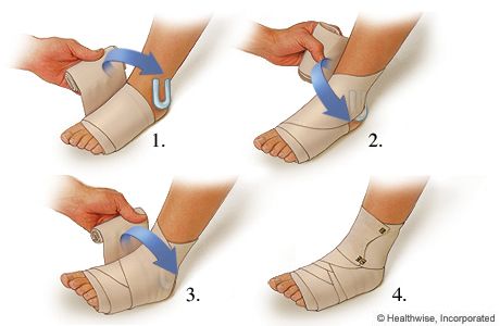 Ankle Wrap Images