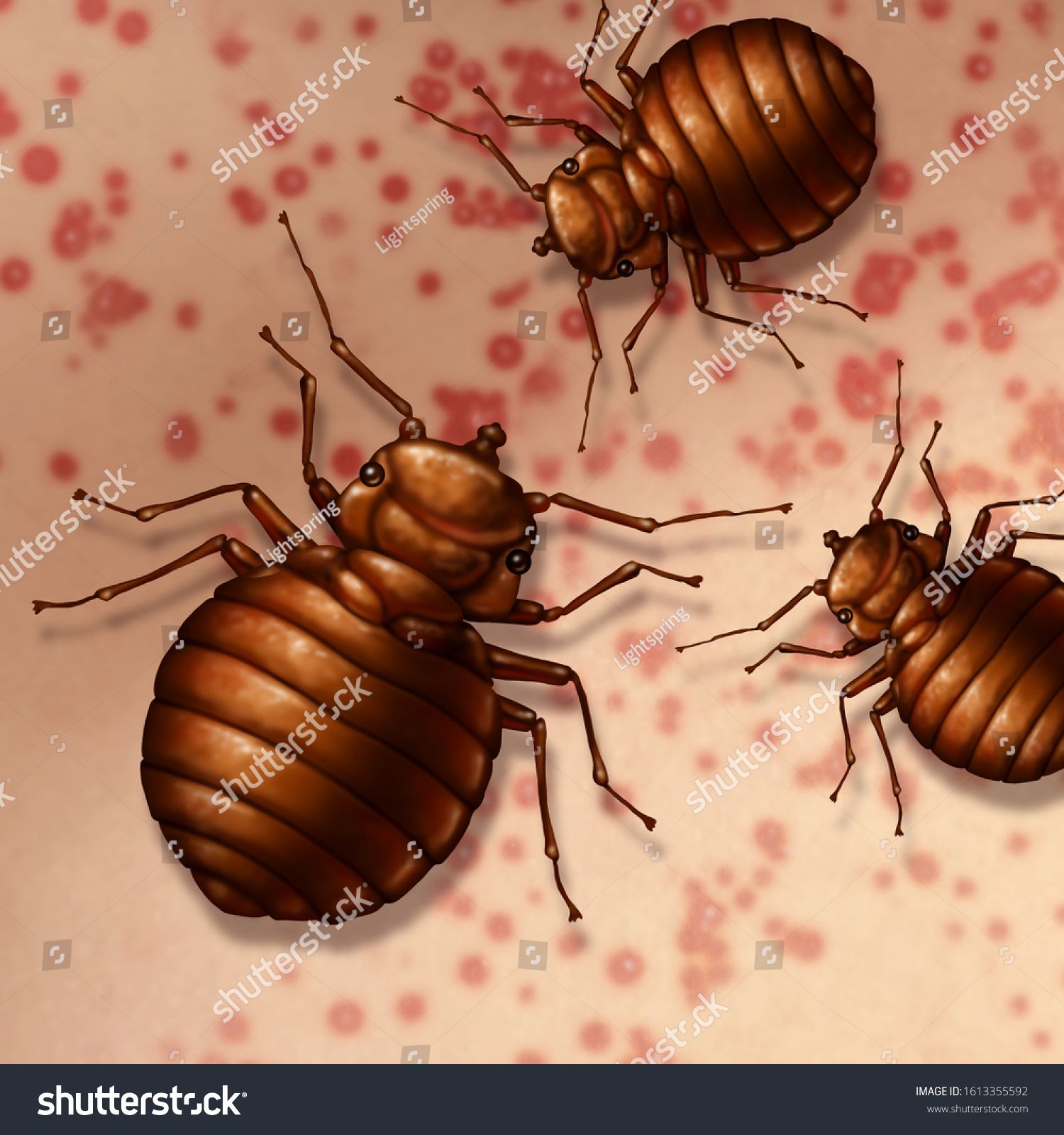 Bed Bug On Skin Bedbugs Bites Stock Illustration 1613355592 | Shutterstock