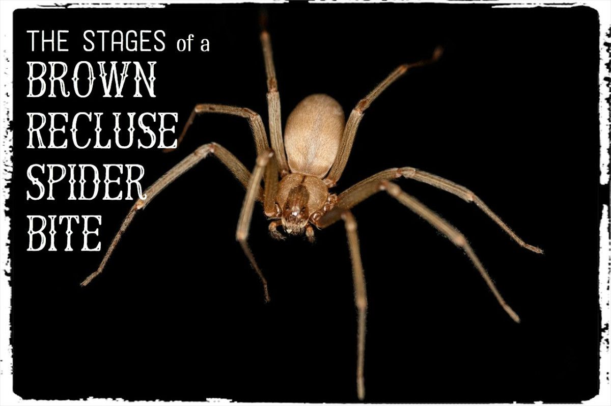 Brown Recluse Bite: Pictures, Stages, Signs & Treatment