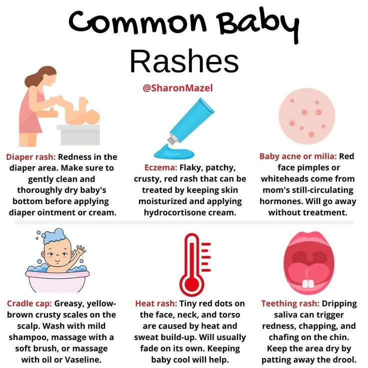 Common Baby Rashes