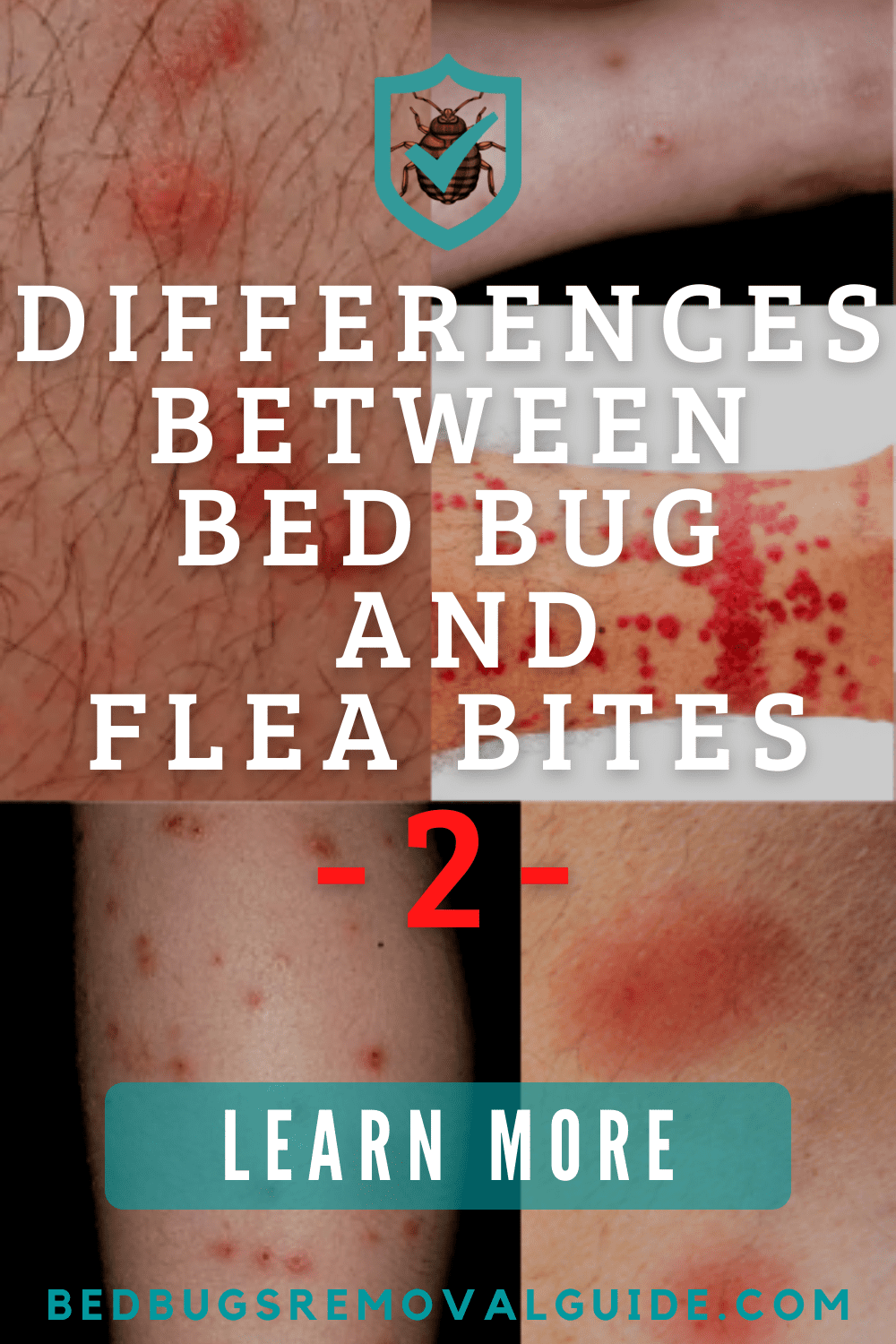 Differences Between Bed Bug and Flea Bites-2