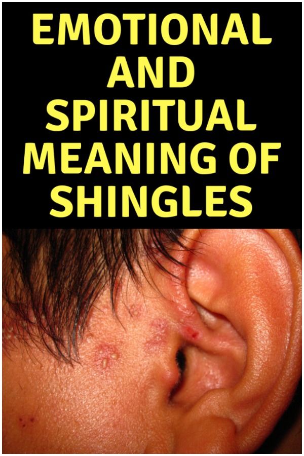 Emotional and Spiritual Meaning of Shingles