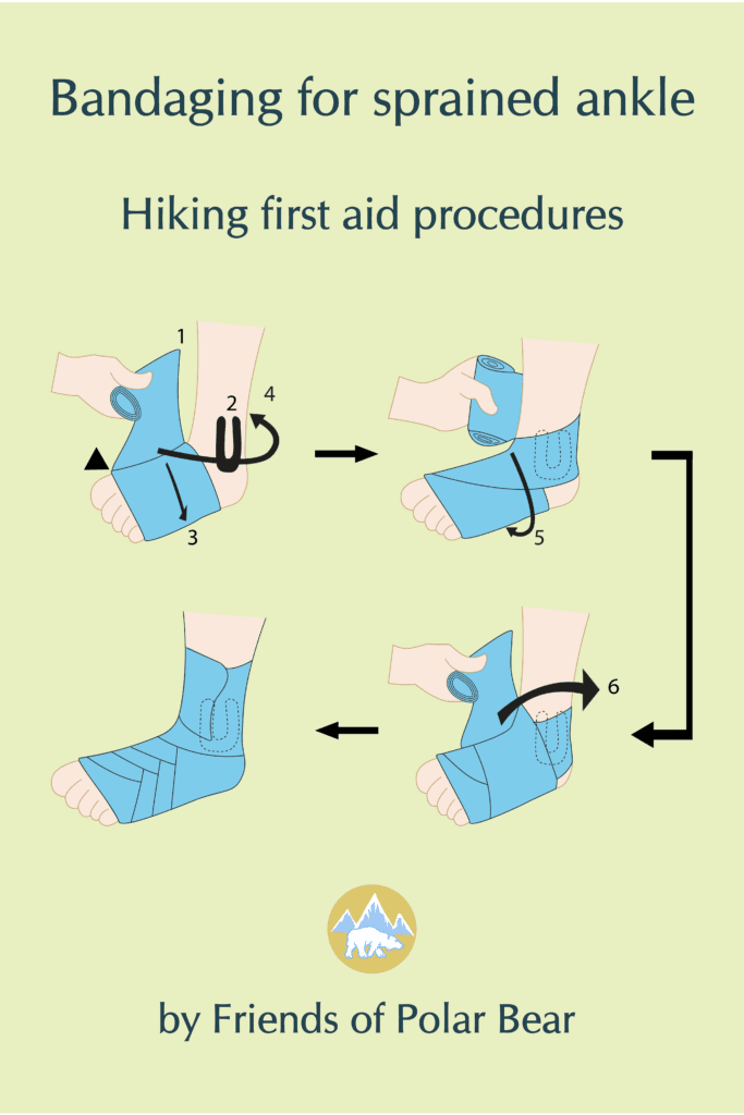 First Aid Ankle Bandaging Images