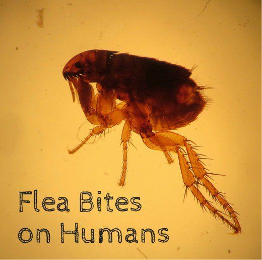 Flea Bites On Humans: Symptoms And Treatment