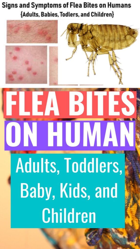 Flea Bites On Humans: What Do Fleabites Symptoms Really Look Like?