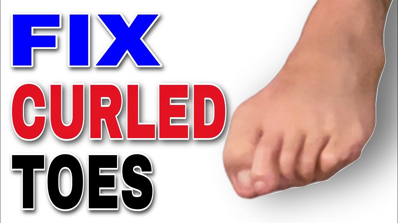 Hammer Toe Exercises and Stretches to Straighten curled toes