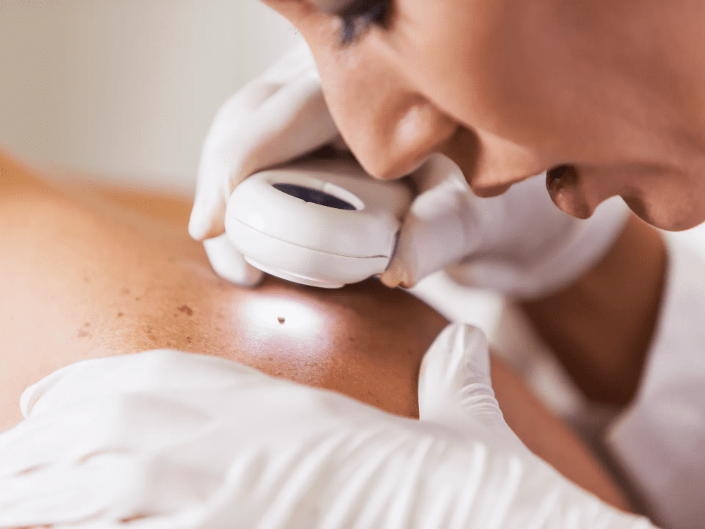 Heres How To Get Rid Of Skin Tags Without Hurting