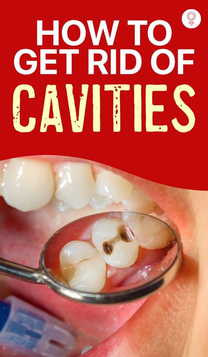 How To Get Rid Of Cavities