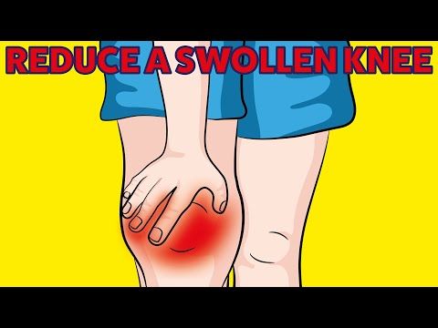 How to Reduce a Swollen Knee with only 6 movements!