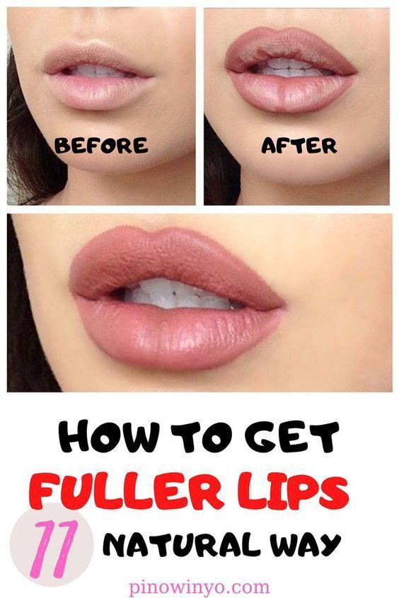 How To Get Fuller Lips 11 Natural Way Images