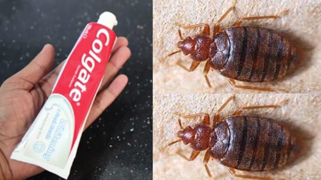 Magic Ingredient How To Kill Bed Bugs Just One
