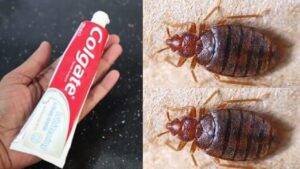 MAGIC INGREDIENT || How To Kill Bed Bugs JUST ONE MINUTE || EASY TIPS ||  HOME R Images