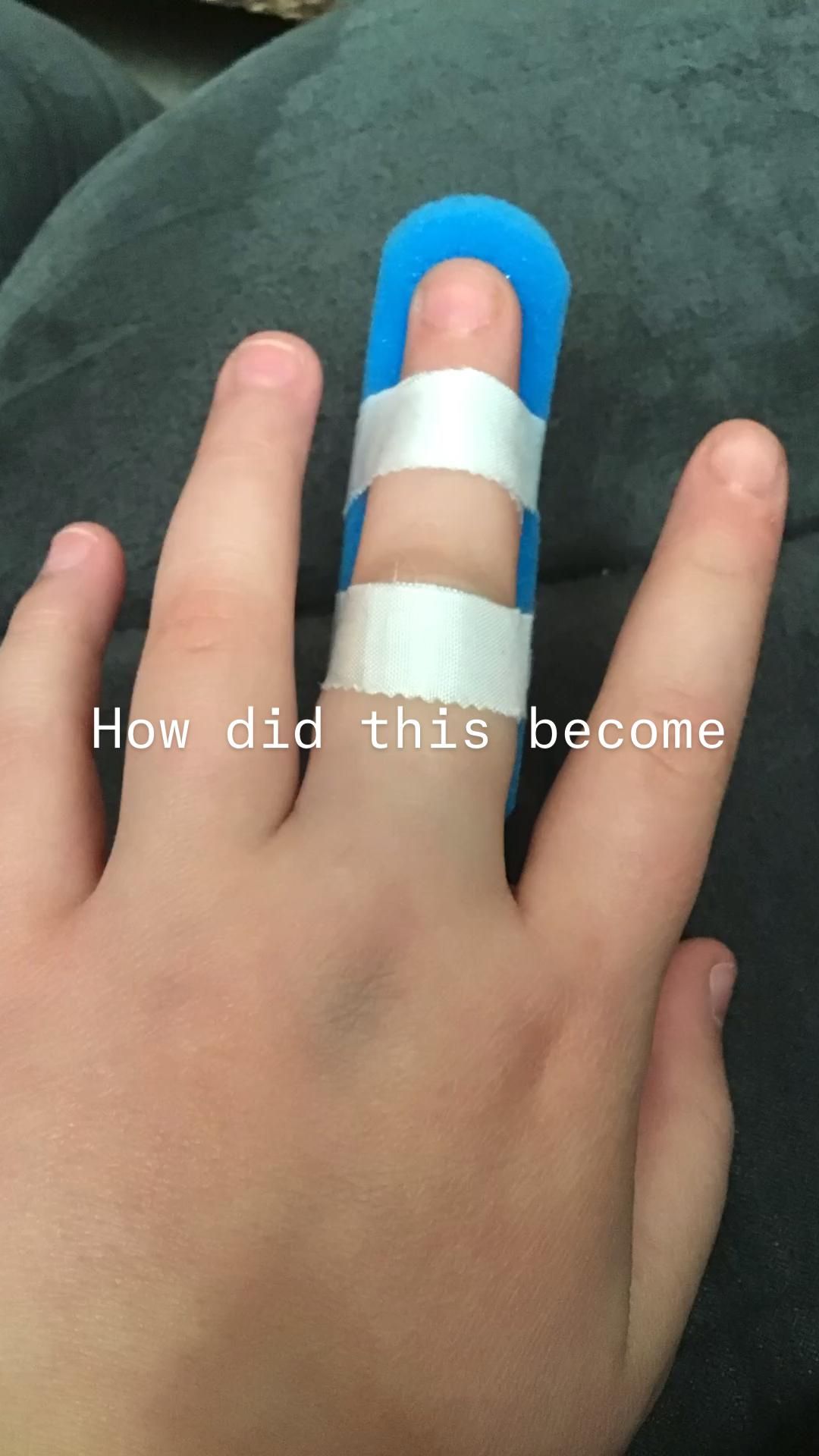 Me and my broken finger