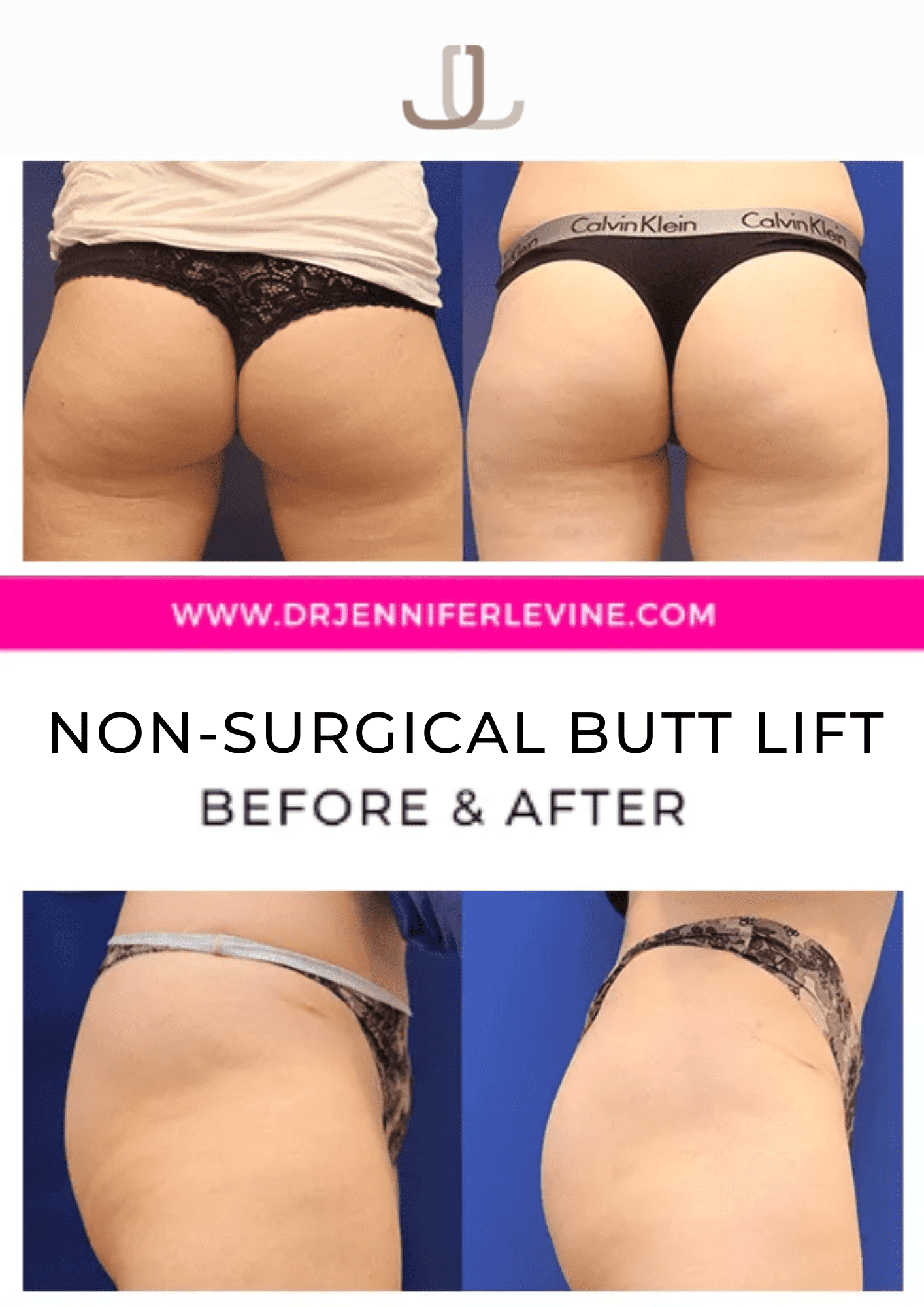 Non,Surgical Butt Lift HD Wallpaper