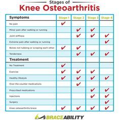 Osteoarthritis Of The Knee | Symptoms, Causes, Treatments &Amp; Exercises