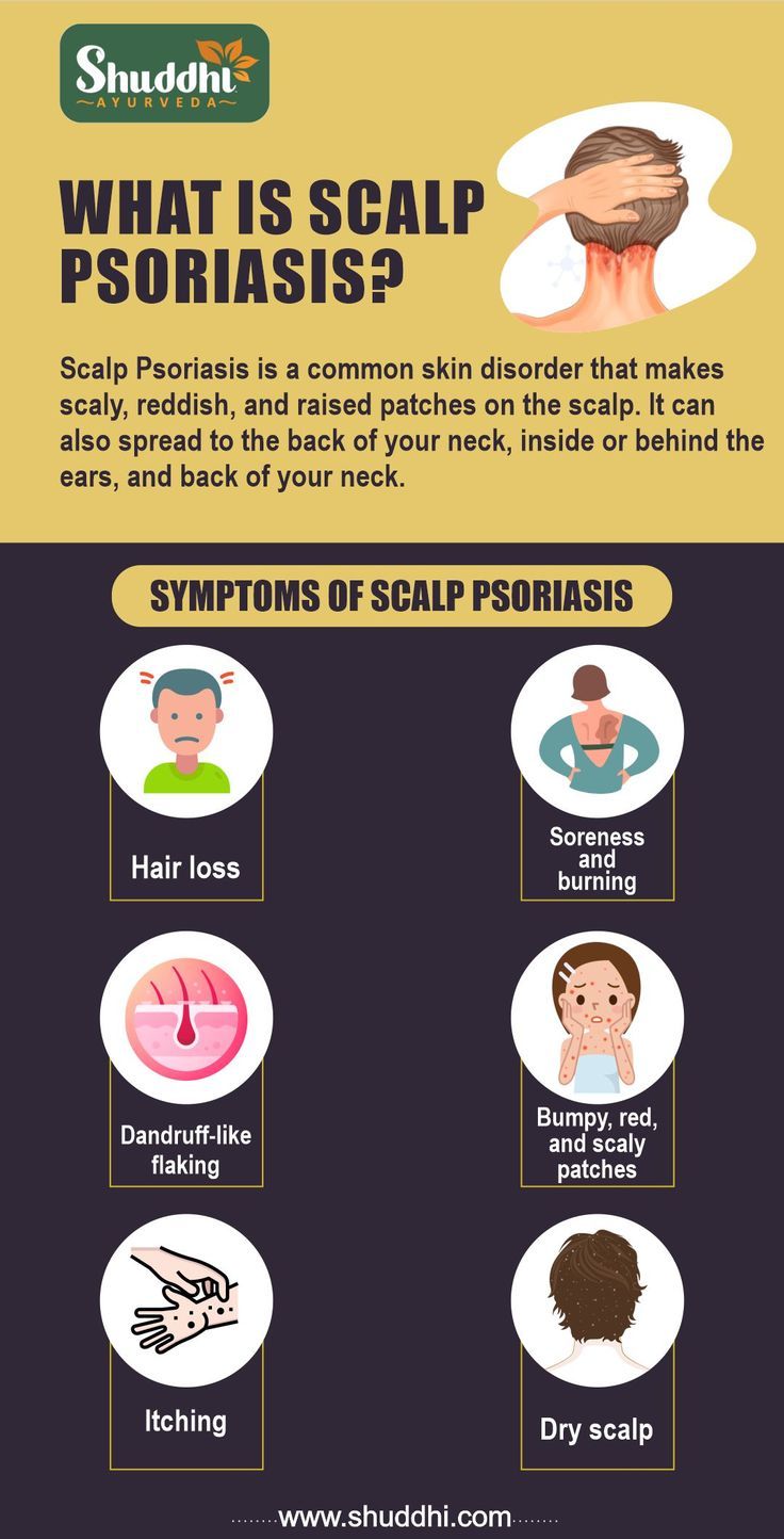 Scalp Psoriasis Treatment HD Wallpaper