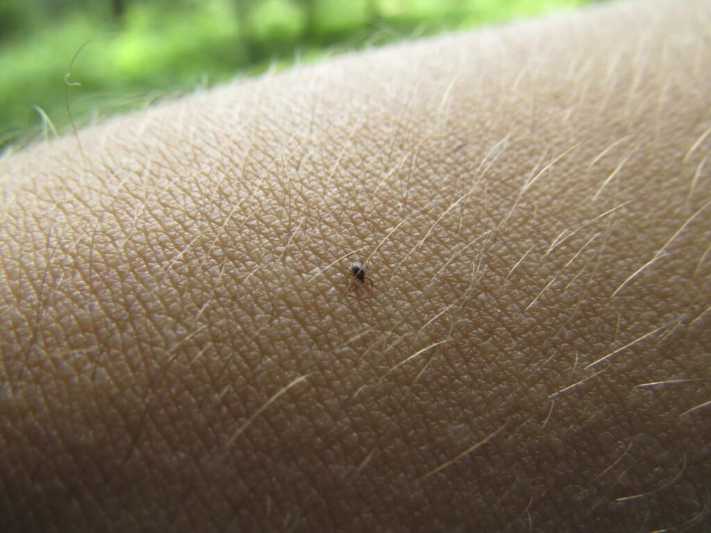 Simple And Effective Home Remedies For Treatment Of Seed Ticks