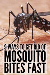 Stop The Itch, 9 Natural Mosquito Bite Remedies that Work HD Wallpaper