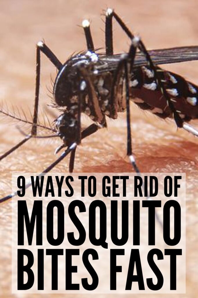 Stop The Itch 9 Natural Mosquito Bite Remedies That Work