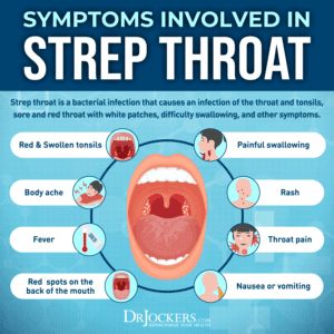 Strep Throat: Symptoms , 15 Natural Support Strategies HD Wallpaper