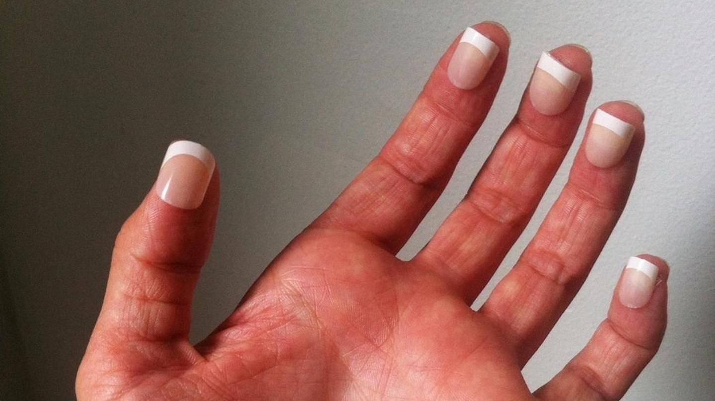 These Extremely Uncomfortable Photographs Are Guaranteed to Make You Squirm