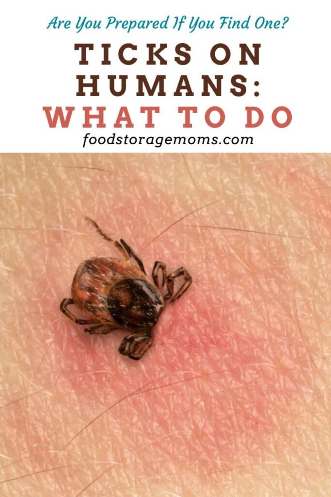 Ticks On Humans What To Do Images