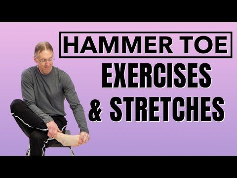 Top 5 Hammer Toe Stretches &Amp; Exercises (Avoid Surgery) (Toe Ext. Stretch)