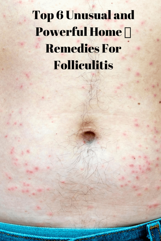 Top 6 Unusual And Powerful Home 🌿 Remedies For Folliculitis