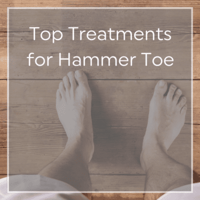 Top Causes And Treatments For Hammer Toe