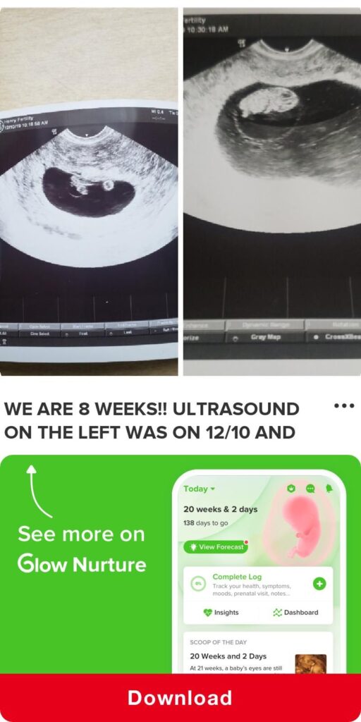 We Are 8 Weeks Ultrasound On The Left Was On
