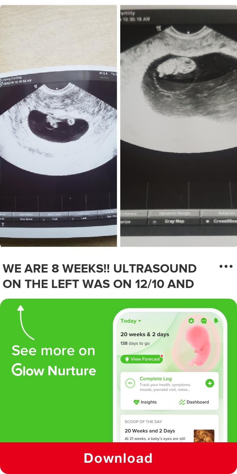 We are 8 weeks,, Ultrasound on the left was on
