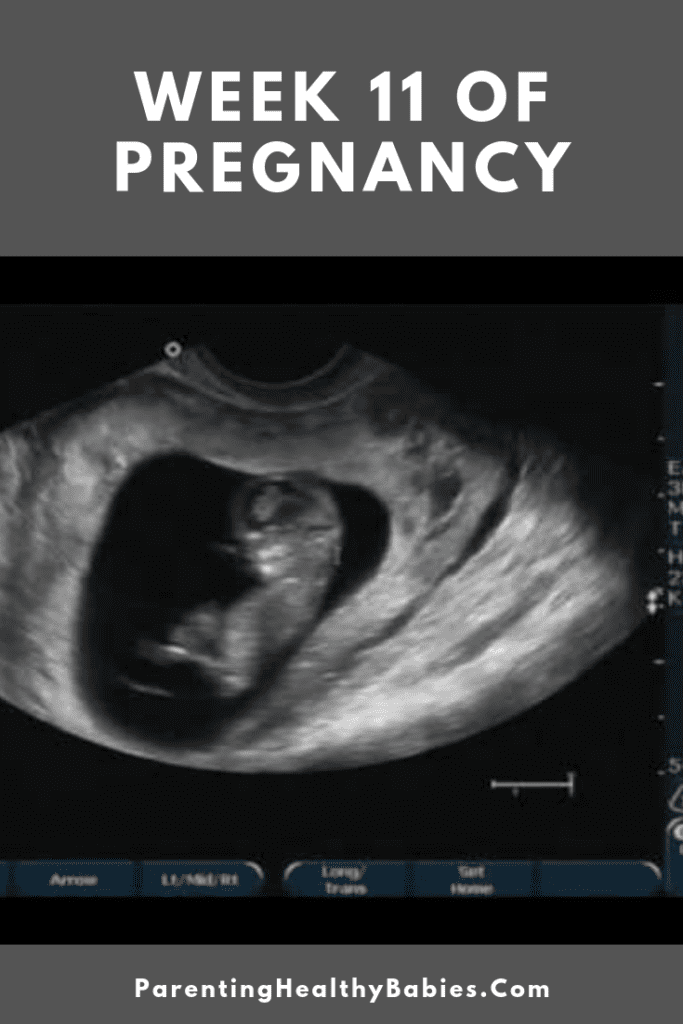 Week 11 Of Pregnancy Pregnancy Week By Week Images
