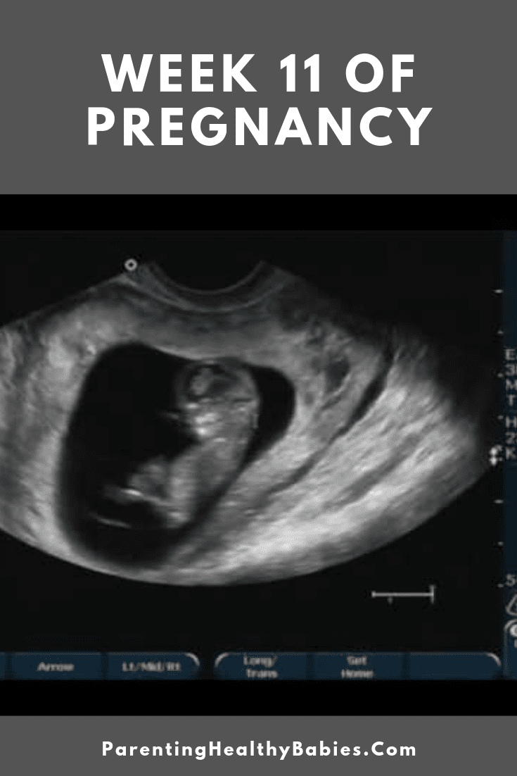 Week 11 of Pregnancy , Pregnancy Week by Week. Images