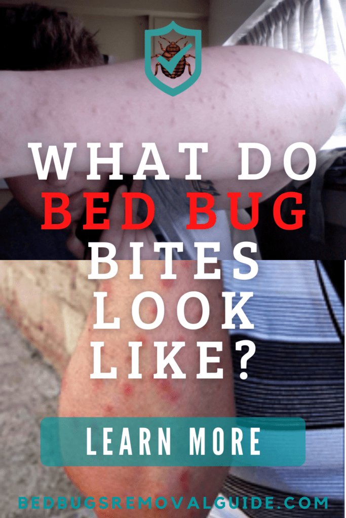 What Do Bed Bug Bites Look Like?