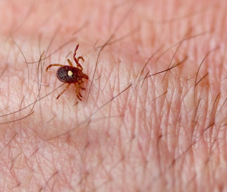 ‘Stranger Than Fiction’: Tick Bite Could Lead To Food Allergy